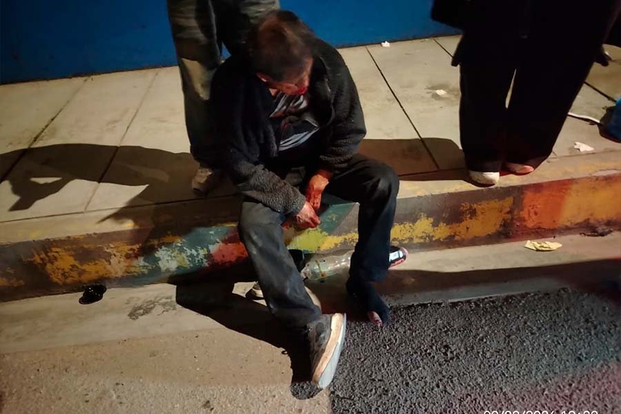 Serenos auxilian a adulto mayor que terminó con el rostro ensangrentado tras aparatosa caída