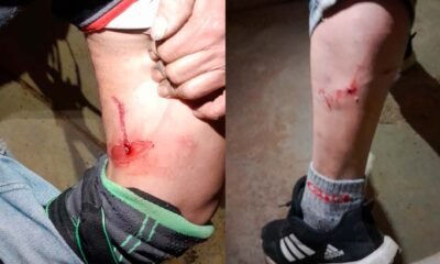 Huancayo: Serenos auxilian a ciudadano tras feroz ataque de perros en el jirón Manco Cápac