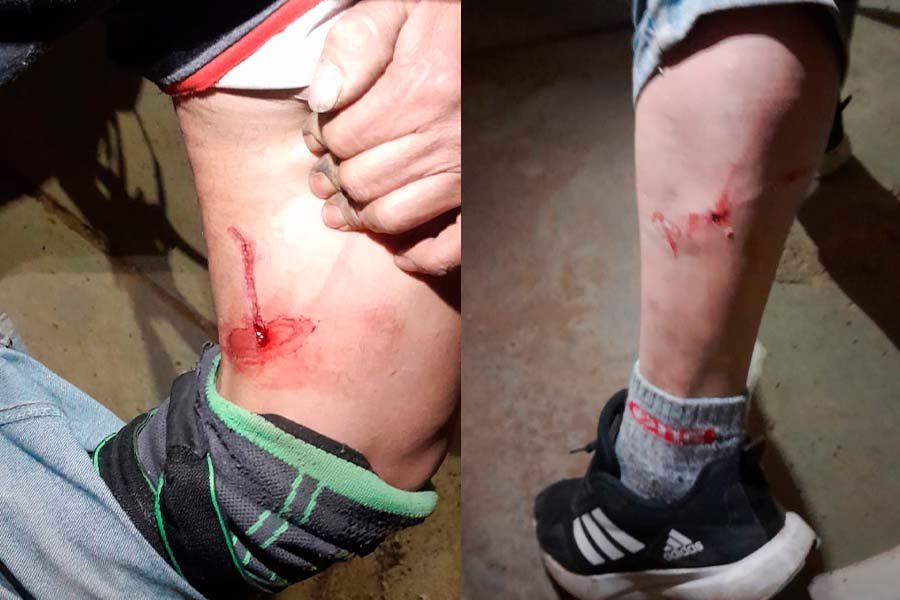 Huancayo: Serenos auxilian a ciudadano tras feroz ataque de perros en el jirón Manco Cápac