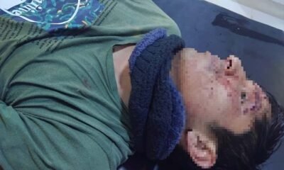 Serenos auxilian a joven herido tras caída en la vía pública durante la madrugada