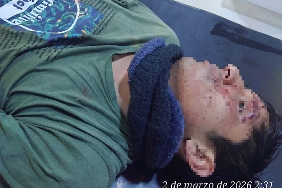 Serenos auxilian a joven herido tras caída en la vía pública durante la madrugada