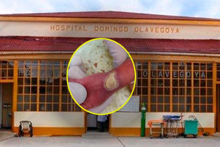 Investigan presunta negligencia médica tras quemadura de tercer grado en recién nacida en hospital