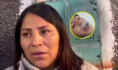 Madre de adolescente quemado en pollería exige justicia y denuncia secuelas físicas y psicológicas