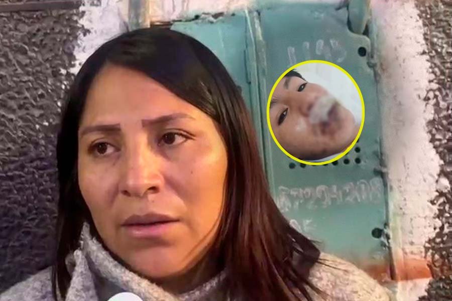 Madre de adolescente quemado en pollería exige justicia y denuncia secuelas físicas y psicológicas