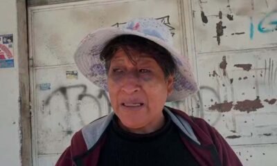 Adulta mayor sufre fractura nasal tras presunta golpiza de policía; familia exige sanción ejemplar