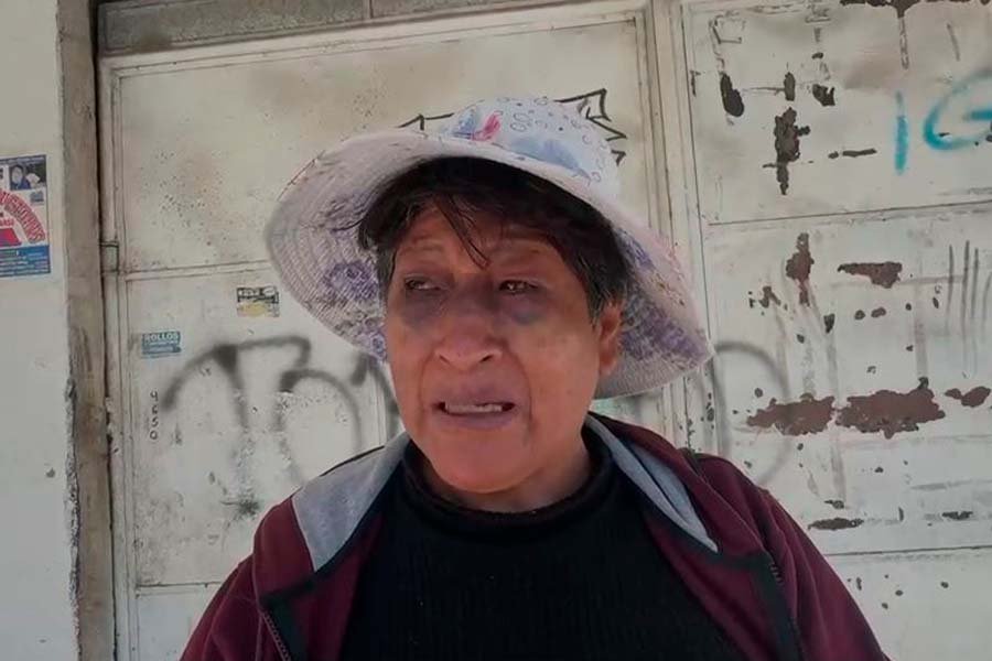 Adulta mayor sufre fractura nasal tras presunta golpiza de policía; familia exige sanción ejemplar