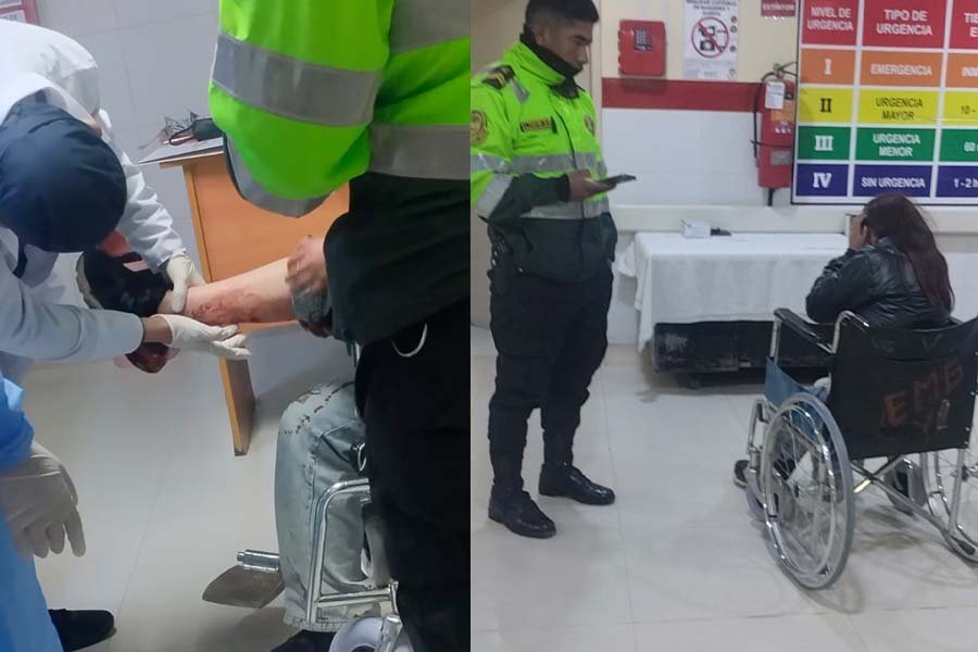 Joven termina con profunda herida en la pierna tras pelea por presuntos celos