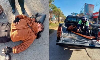 Mujer resulta herida tras ser atropellada por vehículo en la avenida Ferrocarril