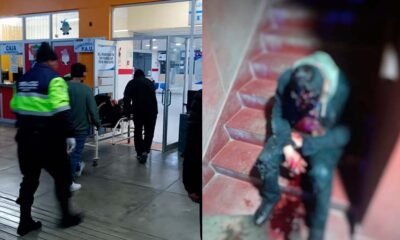 Varón en presunto estado de ebriedad resulta herido tras sufrir caída en gradas de su vivienda