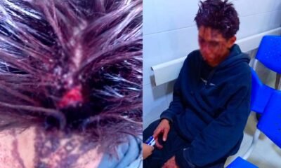 Joven denuncia agresión y pérdida de celular tras pelea en billar