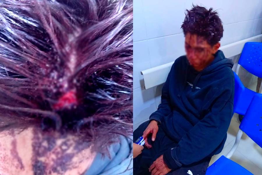 Joven denuncia agresión y pérdida de celular tras pelea en billar
